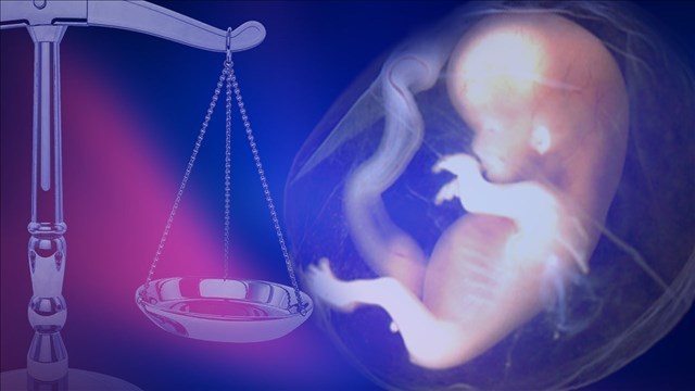 Ohio Senate passes bill banning abortions for Down syndrome